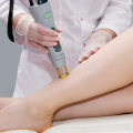 Safety Risks of Laser Hair Removal: What You Need to Know