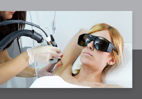 What Type of Protective Eyewear Should I Wear During a Laser Hair Removal Treatment?