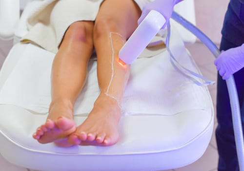 When Can You Not Have Laser Hair Removal? - An Expert's Perspective