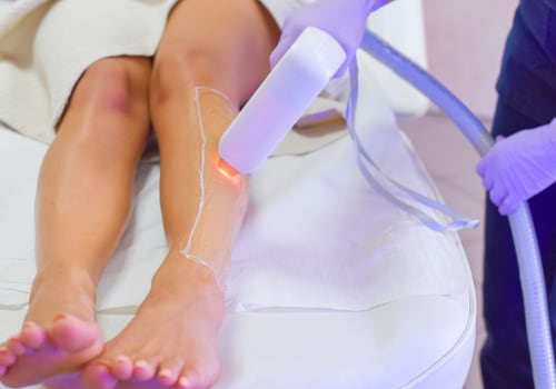 Safety First: How to Ensure a Safe Laser Hair Removal Experience